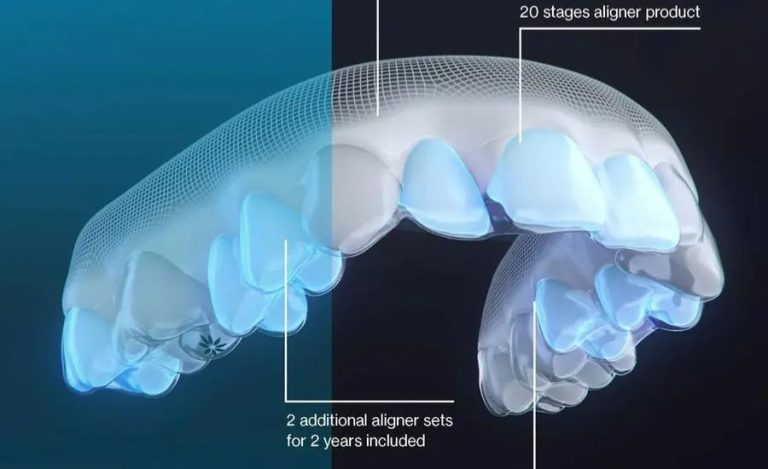 Align Technology Share Price 100$ 400$ Invisalign Cost Costco